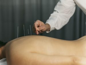 processus-acupuncture